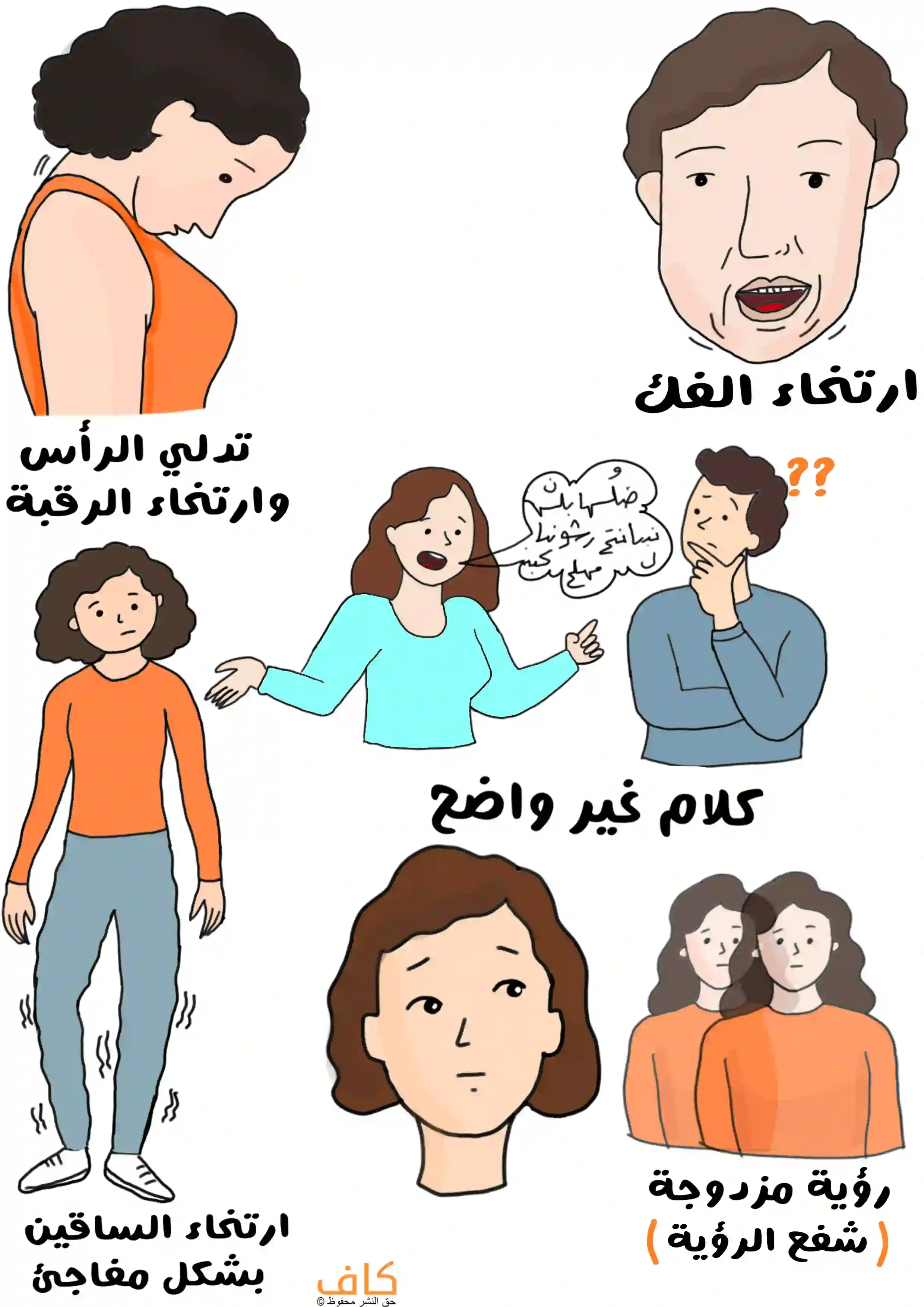 رسم يوضح عدة أعراض جسدية لمرض النوم القهري، حيث يظهر شخص برأس متدلٍ ورقبة مرتخية، وآخر بفك مرتخٍ، وامرأة تتكلم بكلام غير واضح أمام شخص حائر، إضافة إلى شخص بساقين مرتخيتين فجأة، وامرأة ترى صورتين مزدوجتين لنفسها.