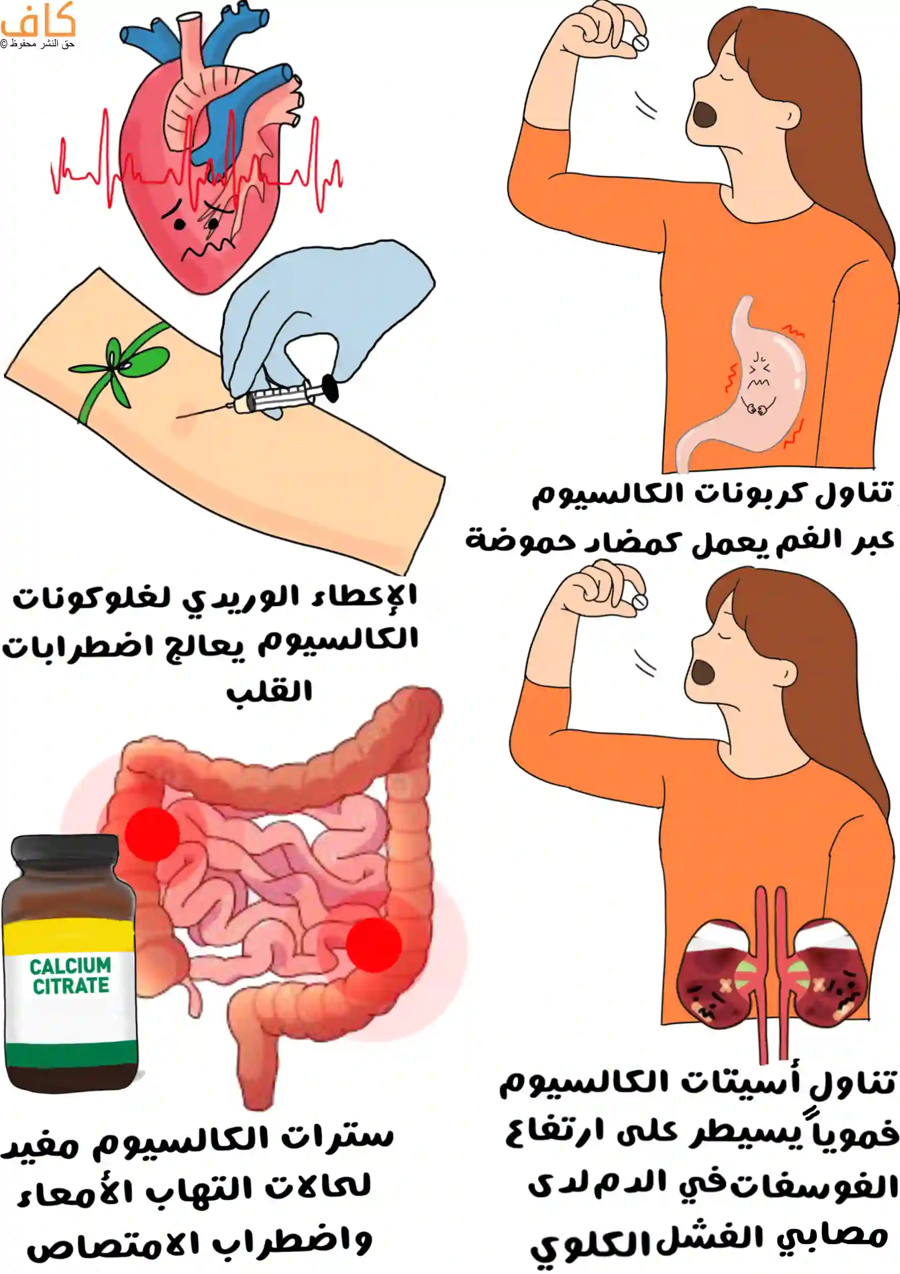 رسمة توضيحية تُظهر أهمية الكالسيوم بأنواعه المختلفة؛ حيث تظهر فتاة تتناول حبوب كربونات الكالسيوم لعلاج الحموضة، وحقنة وريدية لغلوكونات الكالسيوم لعلاج اضطرابات القلب، وزجاجة سترات الكالسيوم بجانب الأمعاء لمعالجة مشاكل الامتصاص، إضافة إلى فتاة أخرى تتناول أسيتات الكالسيوم للسيطرة على ارتفاع الفوسفات عند مرضى الفشل الكلوي.
