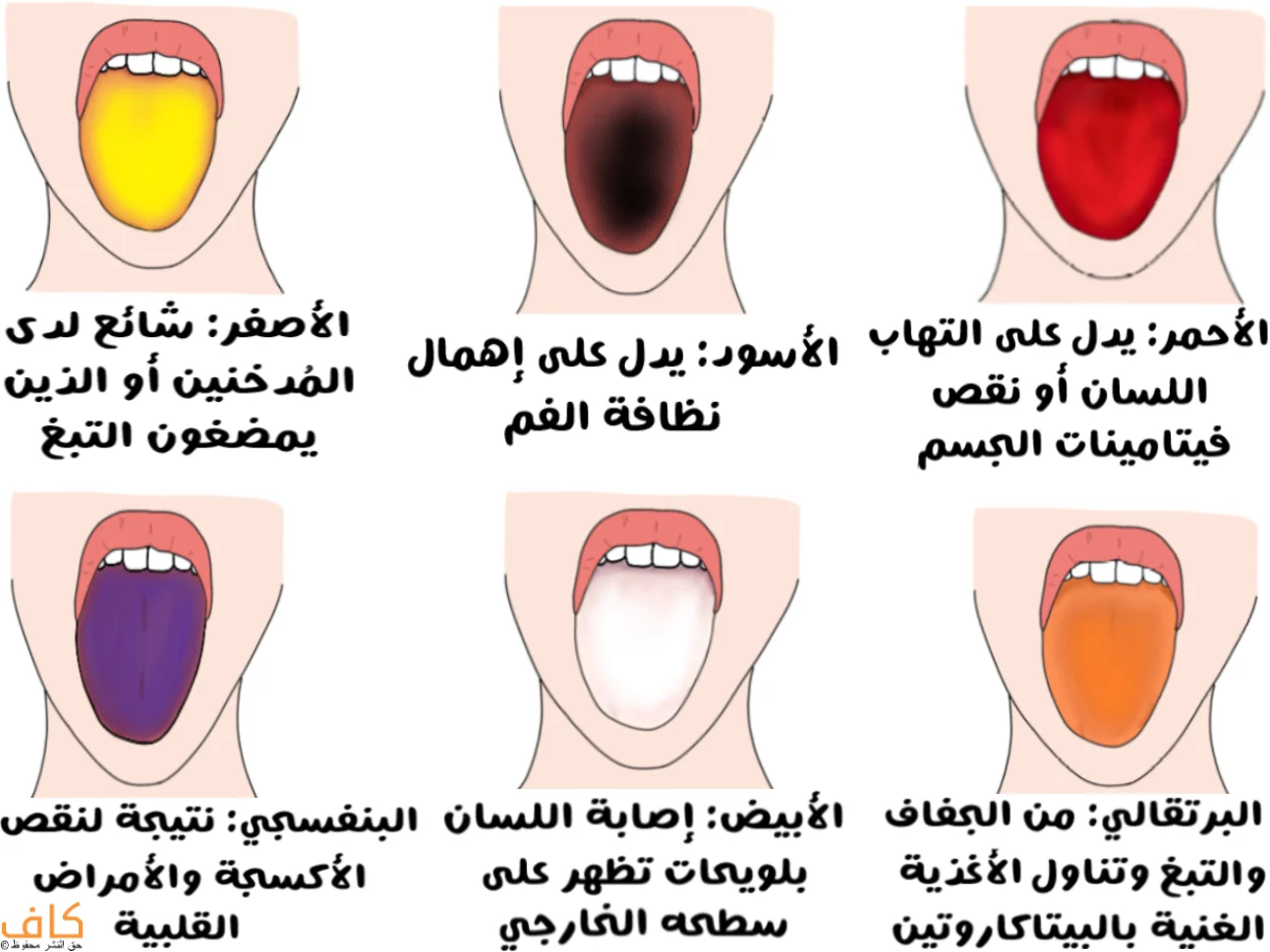 ألوان اللسان ودلالاتها الصحية مثل الأحمر، الأسود، الأصفر، البرتقالي، الأبيض، والبنفسجي