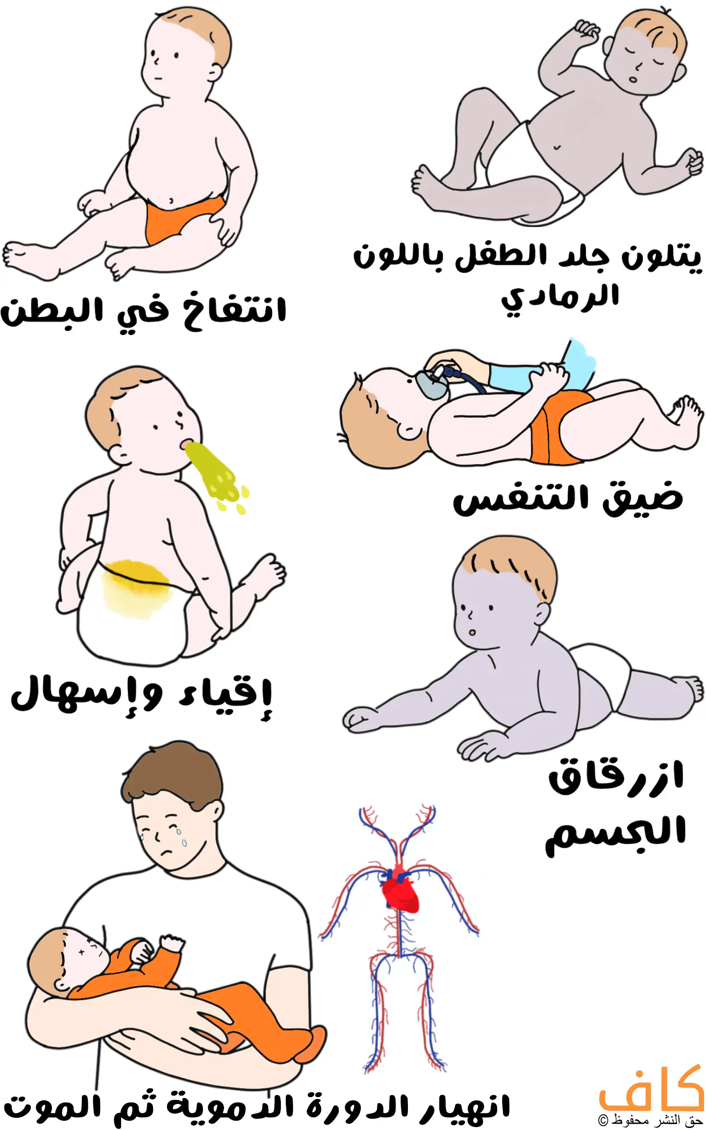 رسم توضيحي يُظهر مجموعة من الأطفال في أوضاع مختلفة مثل طفل بطنه منتفخ يجلس على الأرض، وآخر نائم ولون جلده رمادي، وطفل يتقيأ وهو جالس ويبدو البراز السائل يخرج من حفاضته من الخلف، وآخر يقوم أحدهم بوضع قناع اكسجين للتنفس على وجهه، وآخر جلده مزرقّ يزحف على بطنه، وفي الأسفل أب يحمل طفلًا فاقد الوعي بجانب رسم لجهاز النقل الدموي في الجسم.
