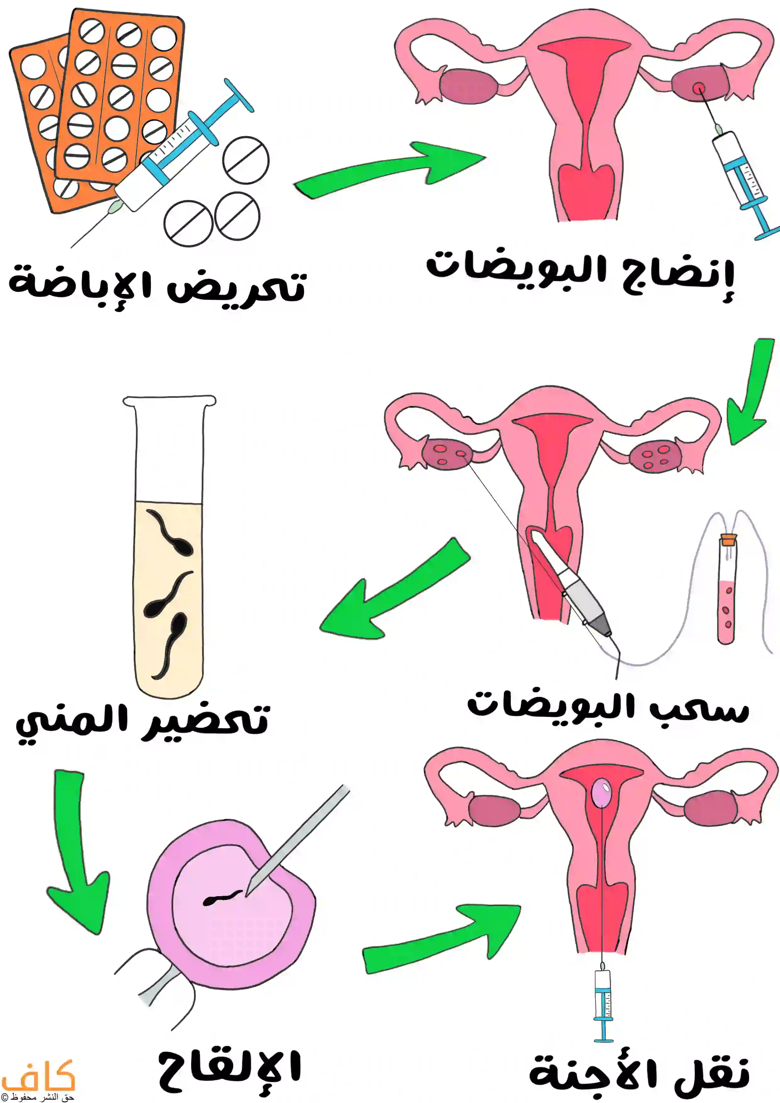 صورة توضيحية تشرح مراحل عملية الإخصاب في المختبر (أطفال الأنابيب) وتبدأ بتحفيز الإباضة عبر الأدوية والحقن، ثم نضوج البويضات، تليها مرحلة سحب البويضات من المبيض، وتحضير عينة السائل المنوي في أنبوب اختبار، ثم عملية الإلقاح في المختبر، وأخيرًا نقل الأجنة المخصبة إلى رحم المرأة.