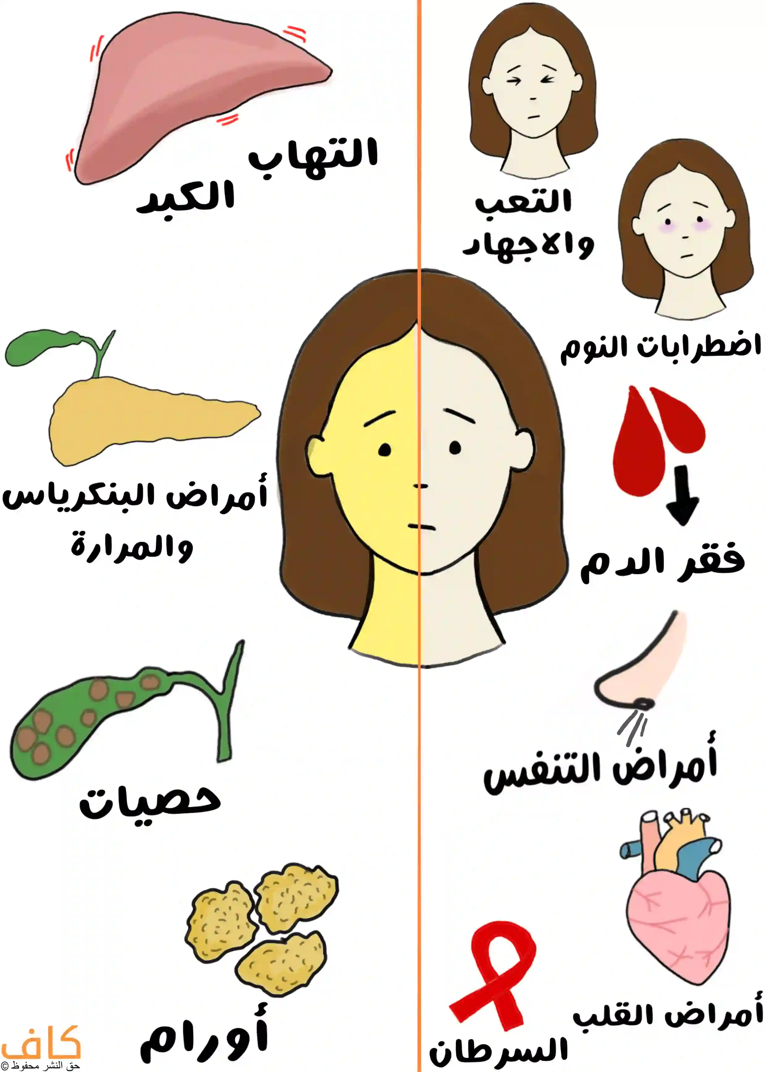 رسم توضيحي يُظهر وجه امرأة مقسوم الى نصفين النصف الأول لونه جلدي طبيعي والنصف الثاني لونه أصفر، وتحيط بها رموز لأعضاء وأمراض مختلفة مثل الكبد، البنكرياس، المرارة، القلب، والرئتين، إلى جانب أشكال تعبّر عن التعب، اضطرابات النوم، فقر الدم، والأورام، ويُعبّر عن الدلالات المرضية التي يمكن أن يشير إليها تغيّر لون البشرة.