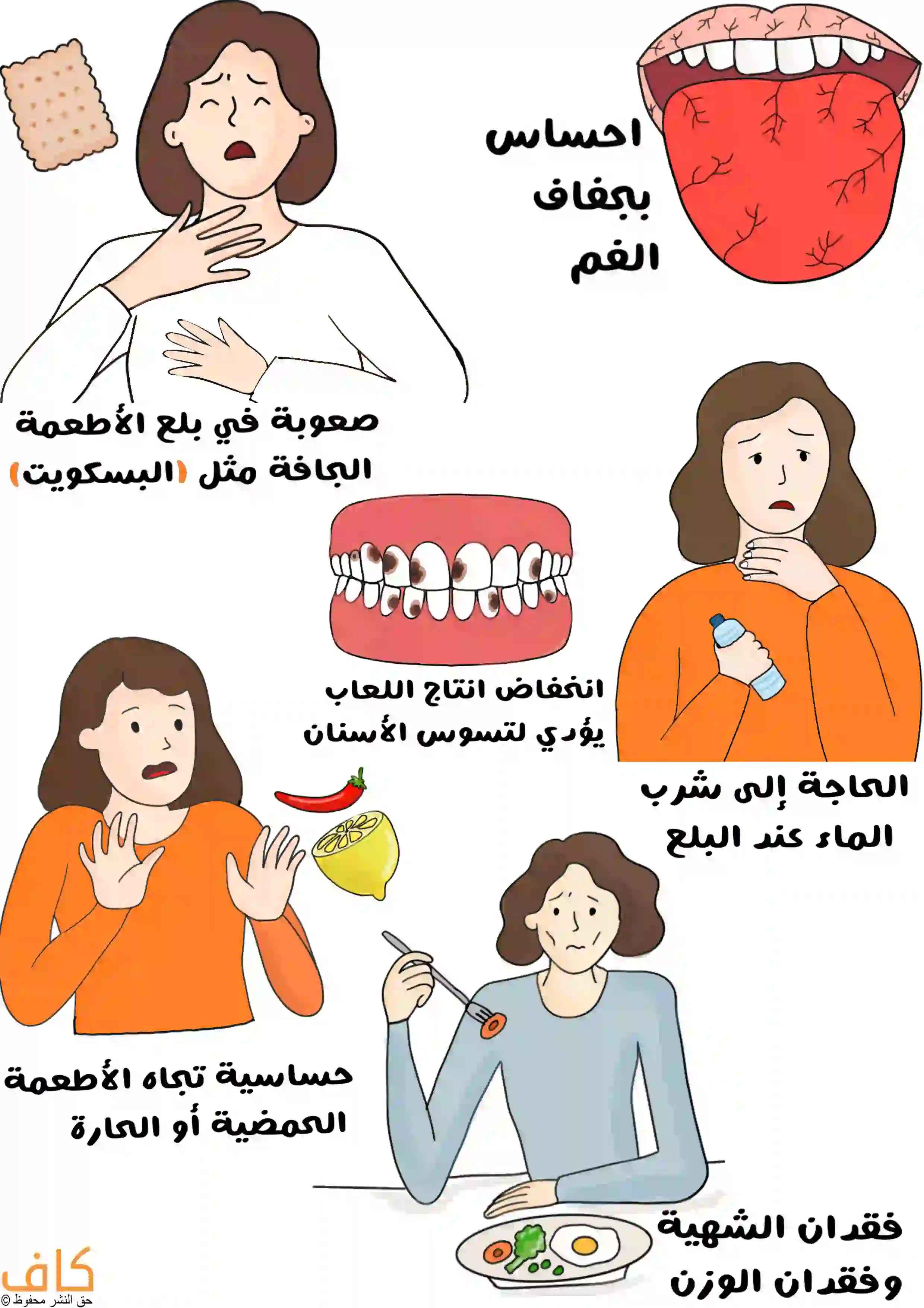 رسم توضيحي يُظهر مجموعة من الأعراض المرتبطة بجفاف الفم، حيث تظهر صورة لسان متشقق، وامرأة تمسك حلقها لتعبّر عن صعوبة في بلع الأطعمة الجافة مثل البسكويت، وصورة فم بأسنان متسوسة ، وامرأة تمسك زجاجة ماء للدلالة على الحاجة المستمرة لشرب الماء، وامرأة تتجنب أطعمة حارة وحامضة ، وفي الأسفل امرأة تبدو فاقدة للشهية أمام طبق طعام.
