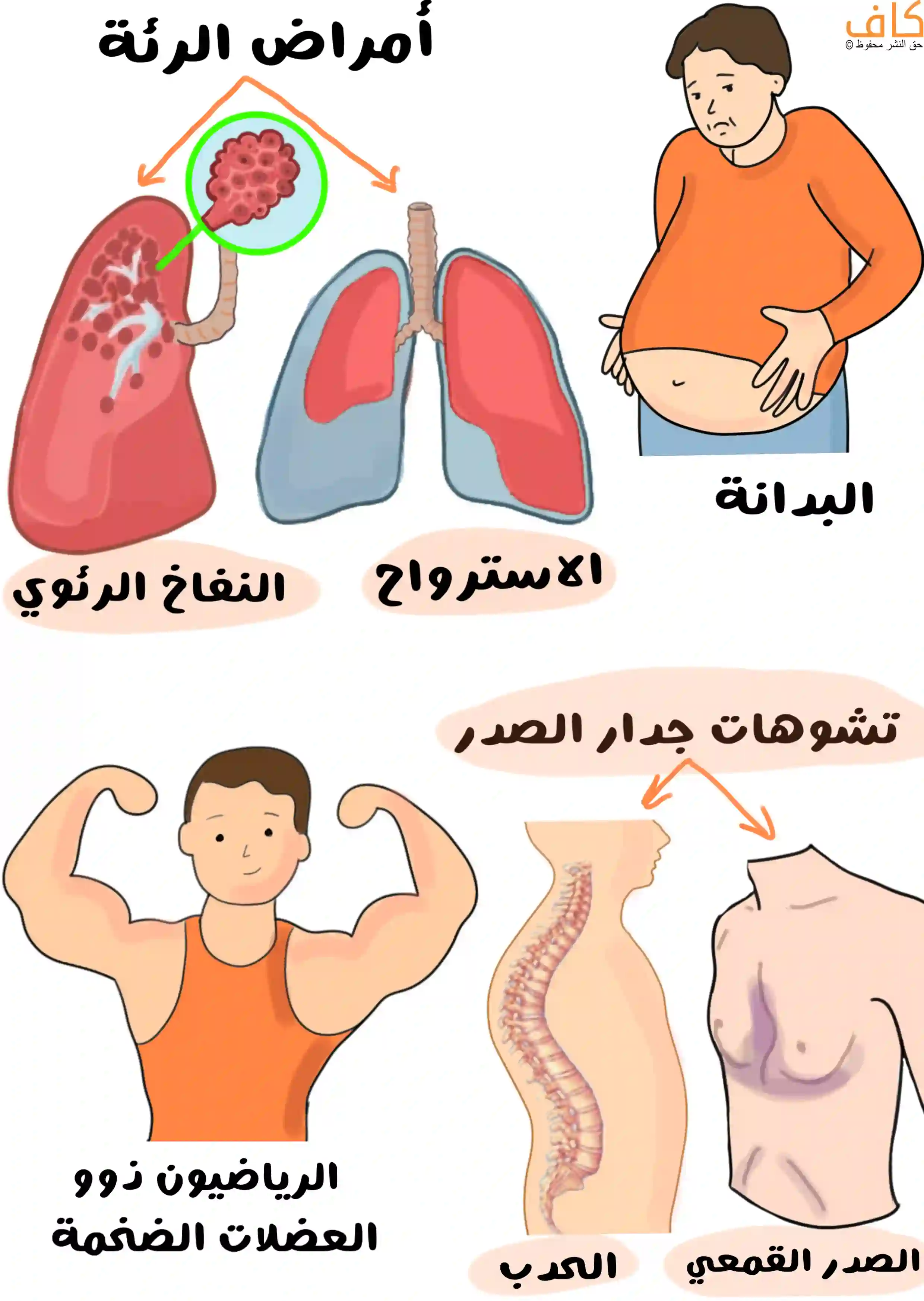 رسمة توضيحية تُظهر الحالات التي يكون فيها سماع صوت القلب صعبًا، وتشمل أمراض الرئة مثل النفاخ الرئوي والاسترواح، والبدانة، وتشوهات جدار الصدر كالصدر القمعي والحدب، إضافة إلى الرياضيين ذوي العضلات الضخمة.