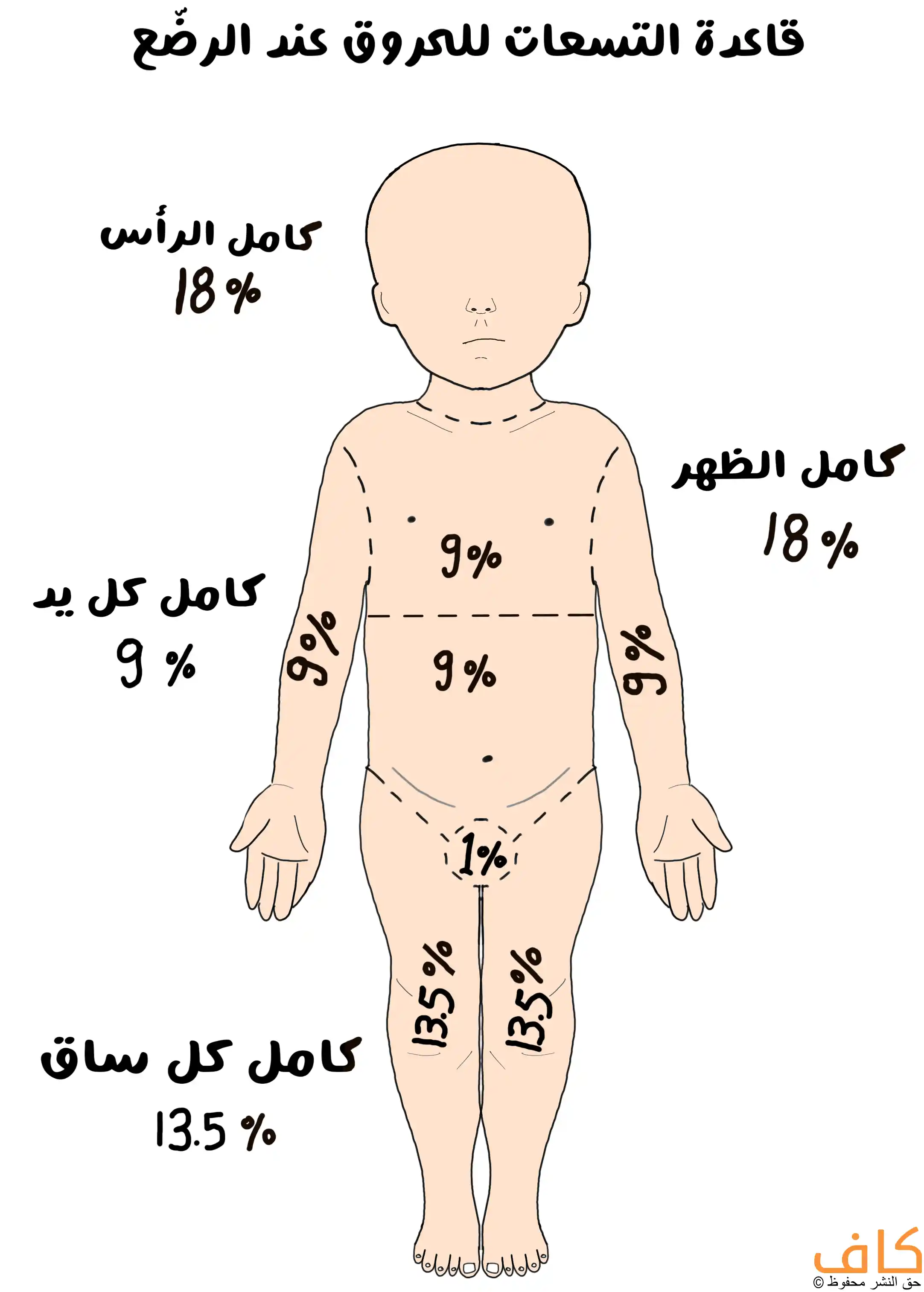 رسم توضيحي لجسم طفل رضيع من الأمام مُقسّم إلى مناطق تحمل نسبًا مئوية توضّح قاعدة التسعات لتقدير مساحة الحروق عند الرضع، حيث يمثل الرأس 18٪، والذراعان 9٪ لكل ذراع، والصدر والبطن 9٪ لكل منهما، والظهر 18٪، والساقان 13.5٪ لكل ساق، ومنطقة الأعضاء التناسلية 1٪، ويُعبّر عن الطريقة الطبية لحساب نسبة الجلد المصاب بالحروق لدى الأطفال.