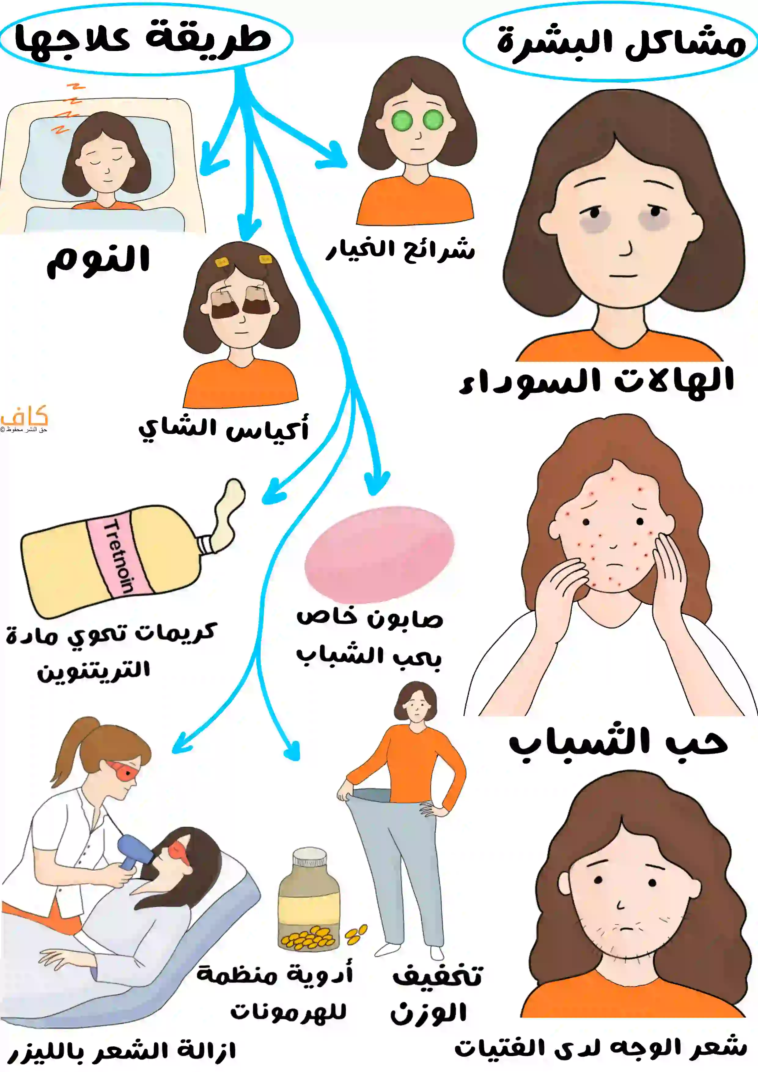 رسم توضيحي يُظهر مشكلات البشرة الشائعة مثل الهالات السوداء، حبّ الشباب، وظهور شعر الوجه لدى الفتيات، مع أسهمٍ تشير إلى طرق العلاج المختلفة مثل استخدام شرائح الخيار وأكياس الشاي والنوم الكافي، واستعمال صابون خاص بحب الشباب، وكريمات تحتوي على التريتينوين، وتخفيف الوزن، وأدوية منظمة للهرمونات، وإزالة الشعر بالليزر.
