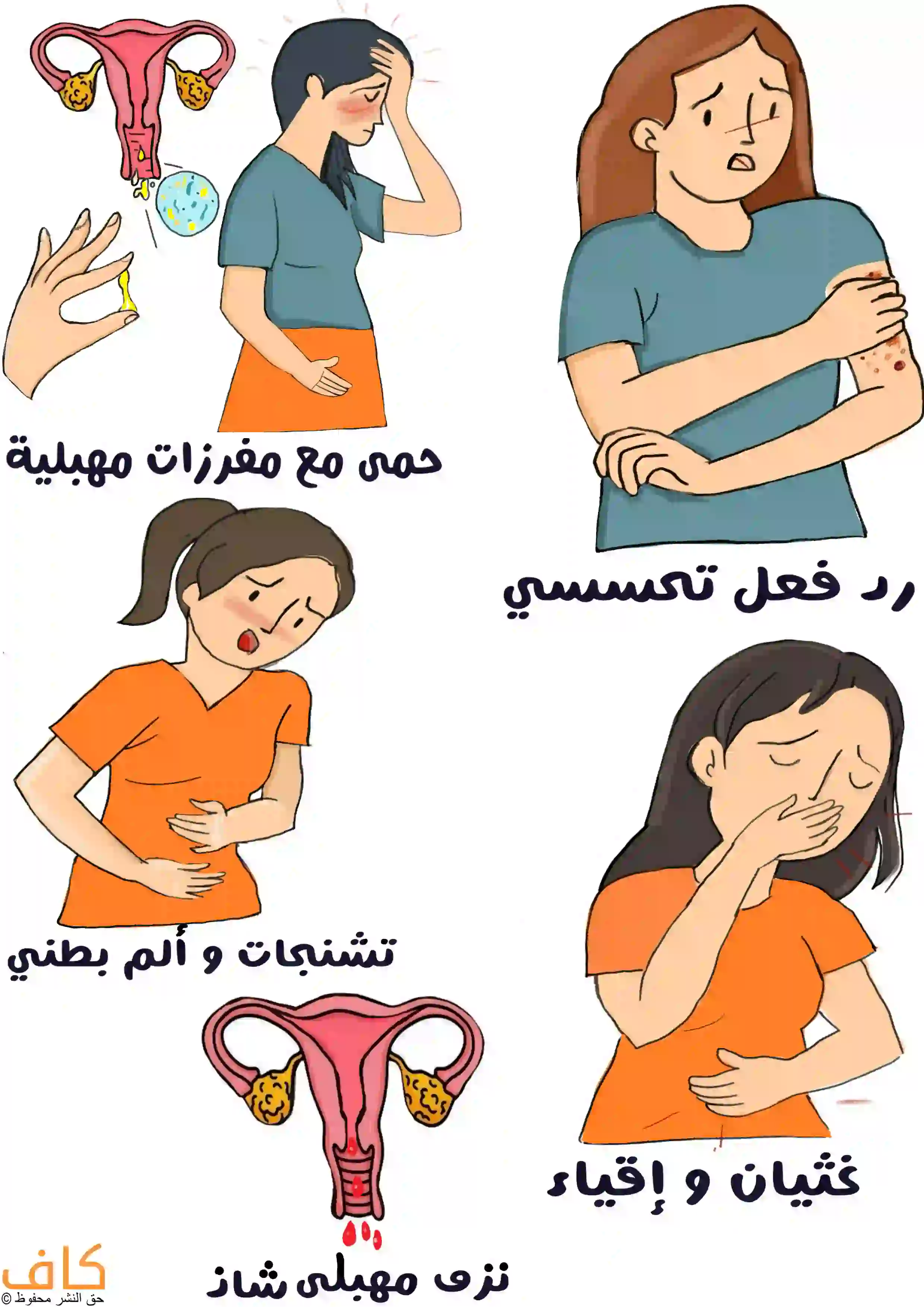 رسم توضيحي تظهر فيه امرأة تعاني من طفح جلدي كرمز لرد الفعل التحسسي، وامرأة أخرى تعاني من إفرازات مهبلية وحمى، وسيدة تمسك بطنها للدلالة على التشنجات والألم البطني، وأخرى تشعر بالغثيان والإقياء، بالإضافة إلى رسم للرحم مع نزف مهبلي.