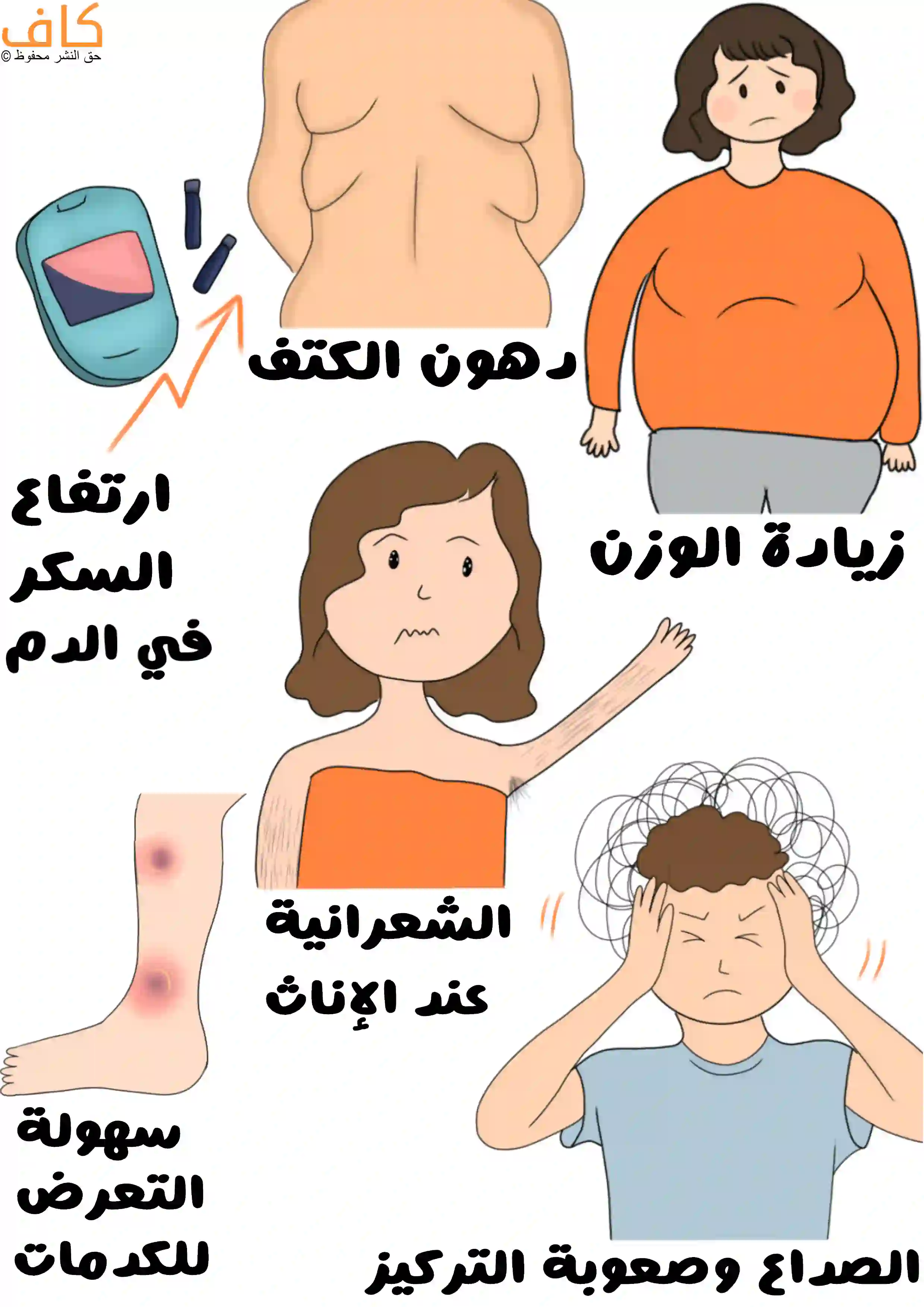 رسم توضيحي يضم عدة مشاهد لأعراض جسدية، تشمل تراكم دهون في منطقة الكتف العلوي وترهلها، امرأة تعاني زيادة الوزن، جهاز قياس سكر الدم مع مؤشر مرتفع لنسبة السكر في الدم، امرأة يظهر لديها شعر زائد في الإبط واليدين، كدمات على ساق أحد الأشخاص، ورجل يضع يديه على رأسه مع علامات صداع وتوتر.