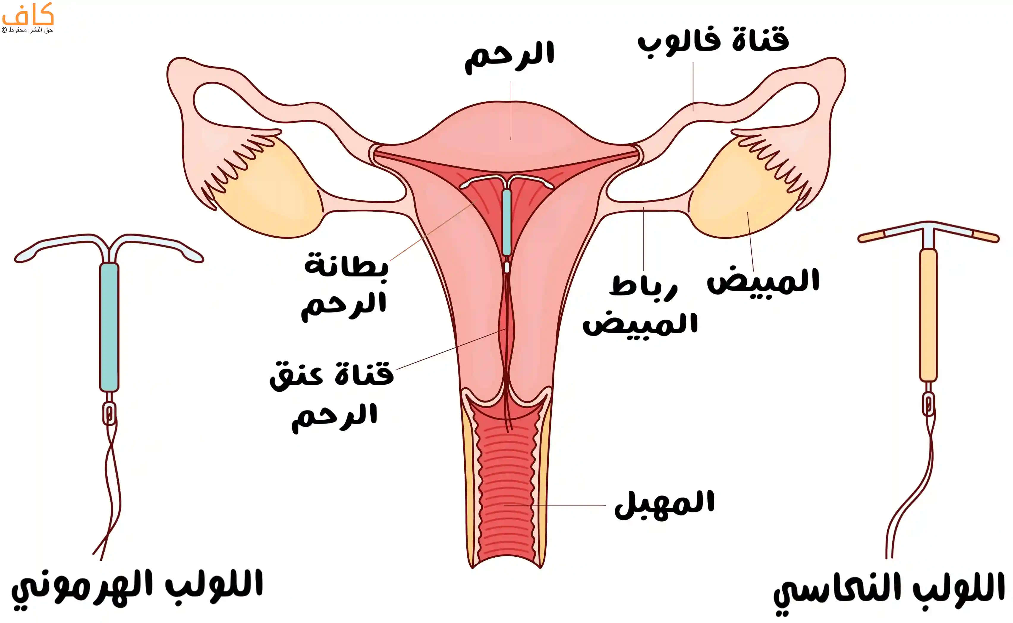 اللوالب الرحمية وأنواعها