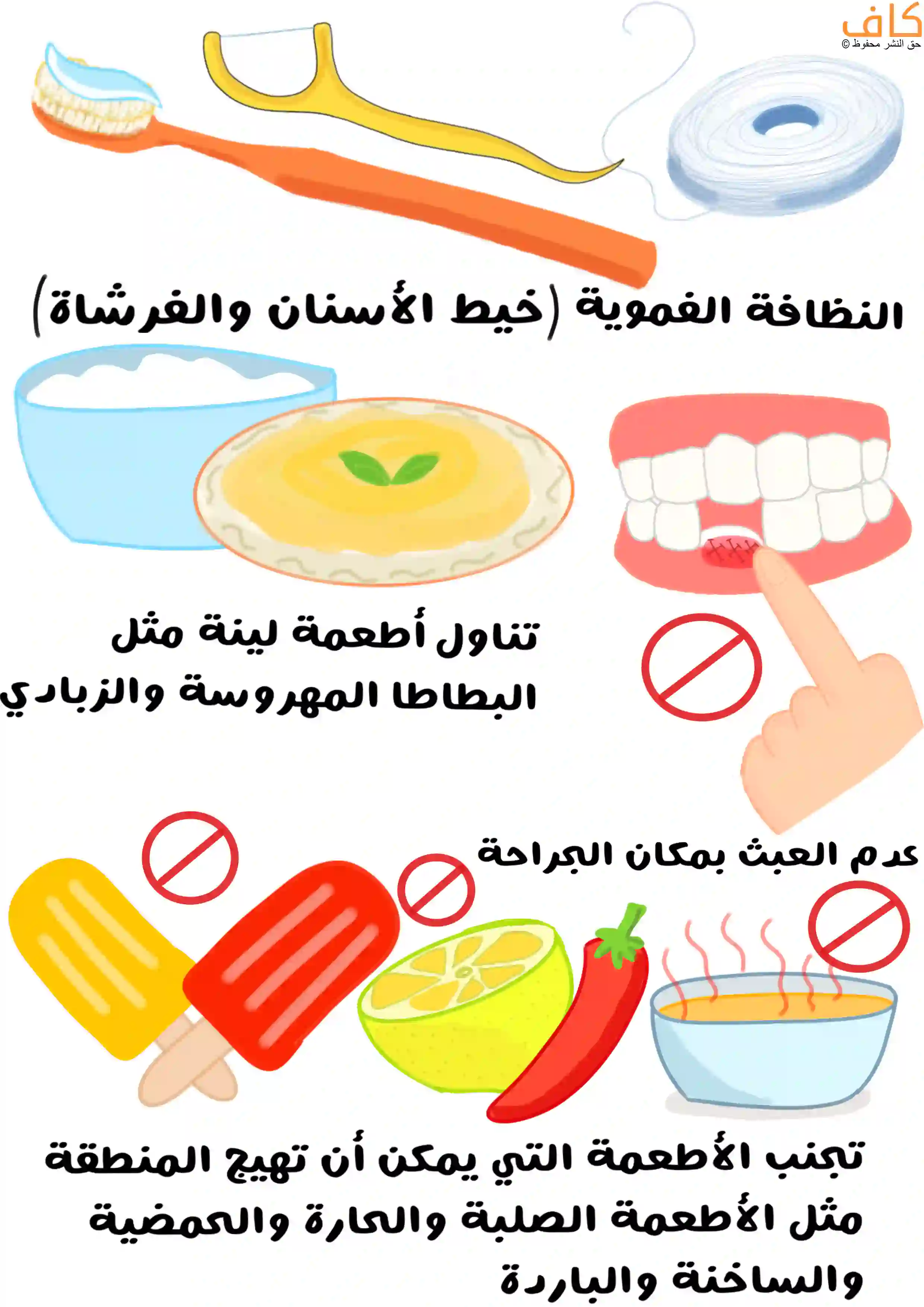 رسم توضيحي يشرح تعليمات العناية بعد عملية طُعم الأسنان، ويُظهر أدوات النظافة الفموية مثل فرشاة الأسنان وخيط الأسنان، وأطعمة لينة كالبطاطا المهروسة والزبادي، مع الإشارة إلى تجنب لمس مكان الجراحة، والامتناع عن تناول الأطعمة الصلبة أو الحارة أو الباردة أو الحامضة، إضافة إلى تجنب المثلجات والفلفل والأطعمة الساخنة.