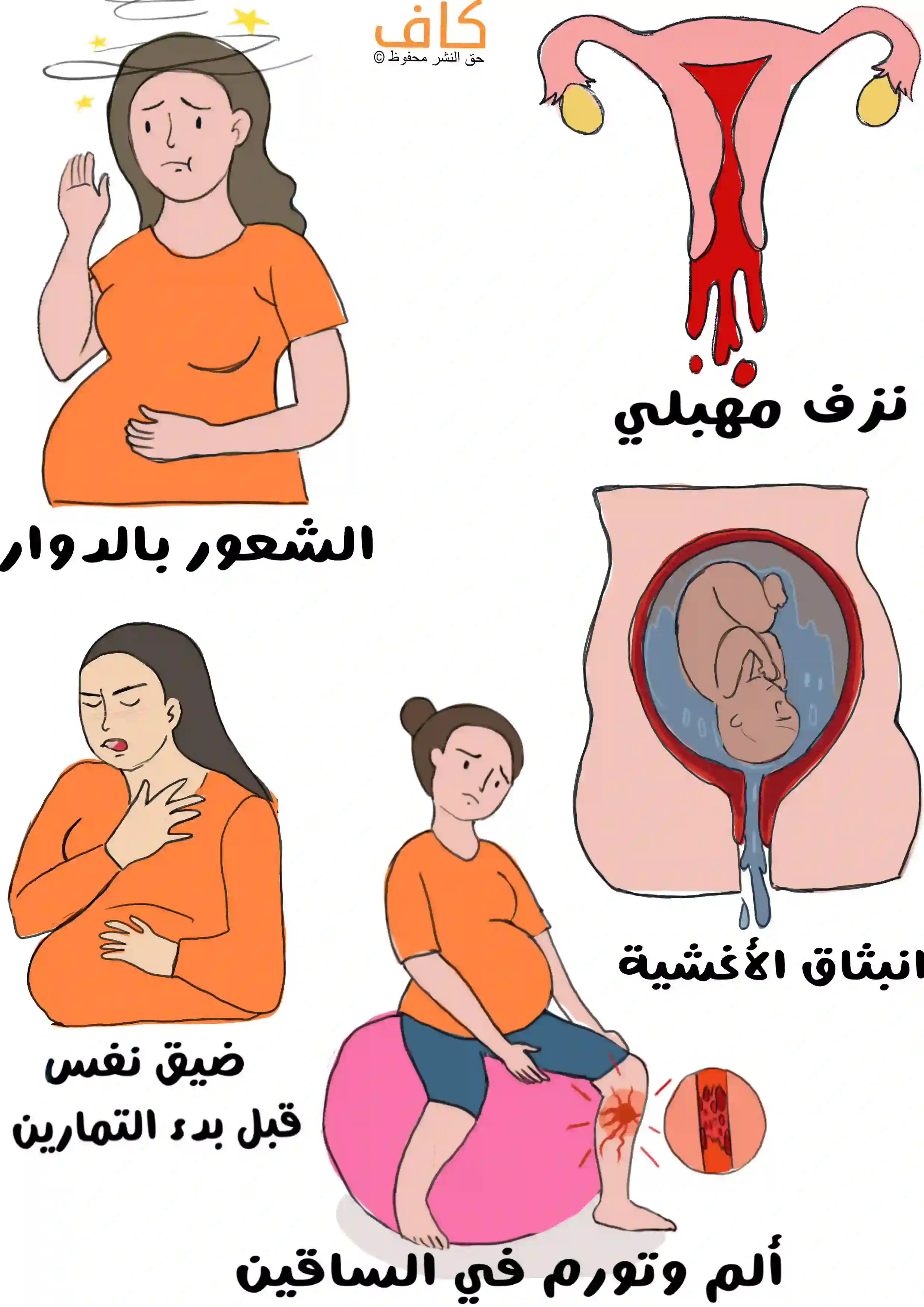 رسم توضيحي يُظهر امرأة حامل تشعر بالدوار، وأخرى تعاني من ضيق نفس قبل بدء التمارين الرياضية، مع رسم يوضح نزفًا مهبليًا، وانبثاق الأغشية مع تسرب السائل الأمنيوسي، بالإضافة إلى ألم وتورم في الساقين عند امرأة حامل.