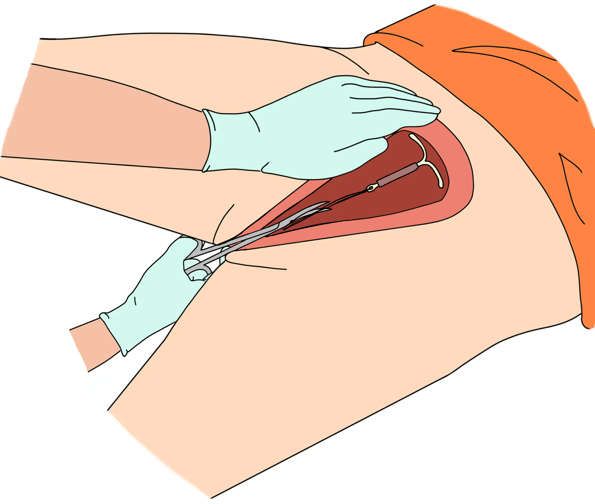 قص خيط اللولب 10