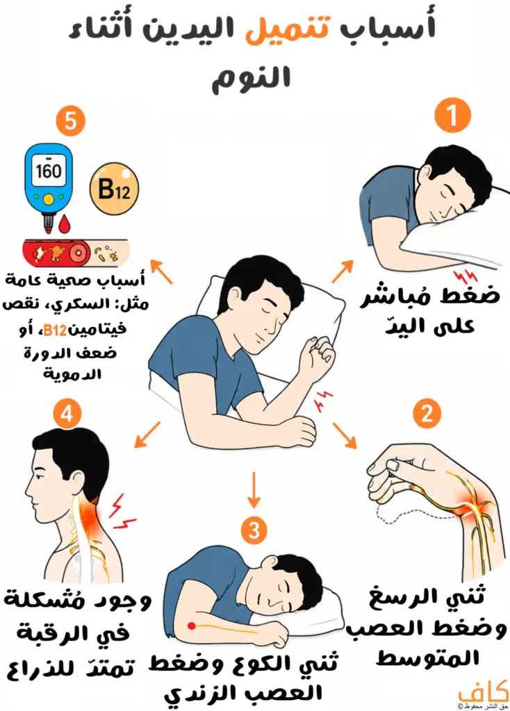 رسم توضيحي يُظهر رجلًا نائمًا في أوضاع مختلفة مع رسومات لليد والرقبة والأعصاب، ويُبيّن الأسباب الشائعة لتنميل اليدين أثناء النوم مثل ضغط الأعصاب ومشكلات الرقبة وبعض الحالات الصحية.