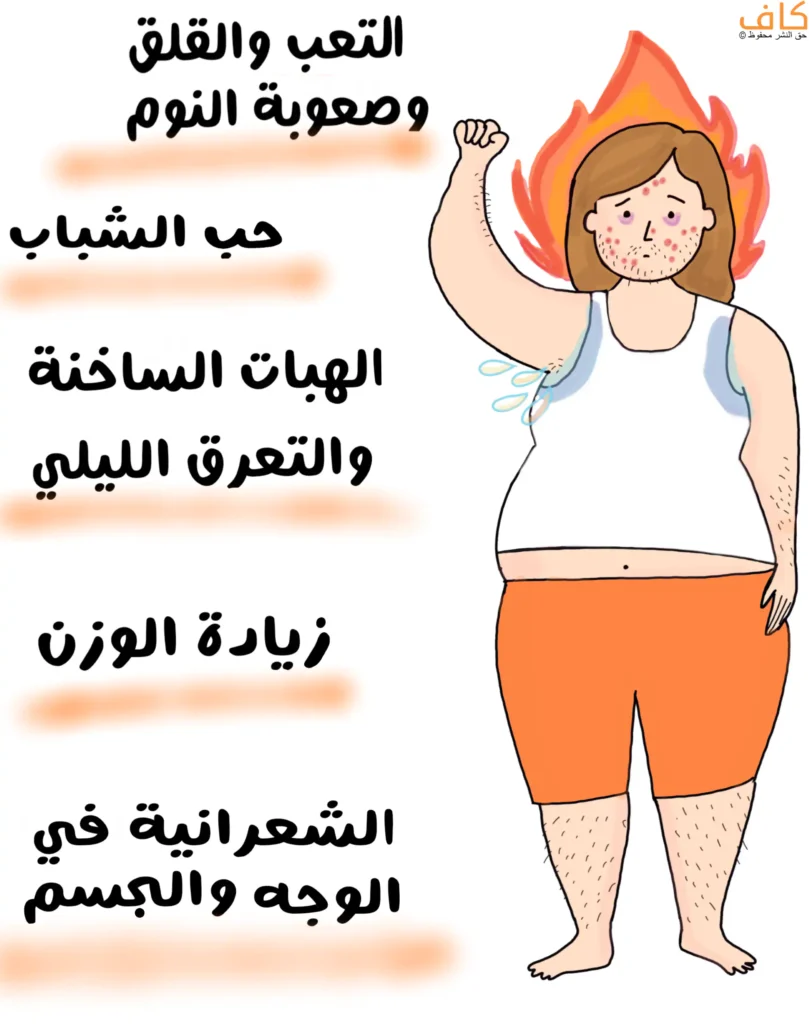 رسم توضيحي يُظهر امرأة تعاني تغيرات جسدية وهرمونية، مع تعبيرات تعب وقلق، وتعرّق واضح من الإبط، وظهور حبّ الشباب، وزيادة في الوزن، ونمو شعر زائد في الوجه والجسم، ويُعبّر عن أعراض اختلال توازن الهرمونات الجنسية.