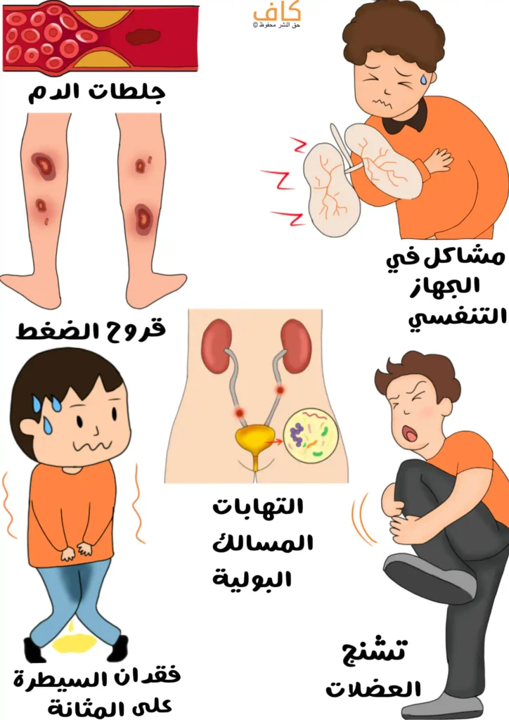 رسم توضيحي يوضح أعراض الشلل الدماغي، ويشمل جلطات الدم في الأوعية، تقرحات ناتجة عن الضغط في الساقين، مشكلات في الجهاز التنفسي، التهابات المسالك البولية، فقدان السيطرة على المثانة، وتشنج العضلات.