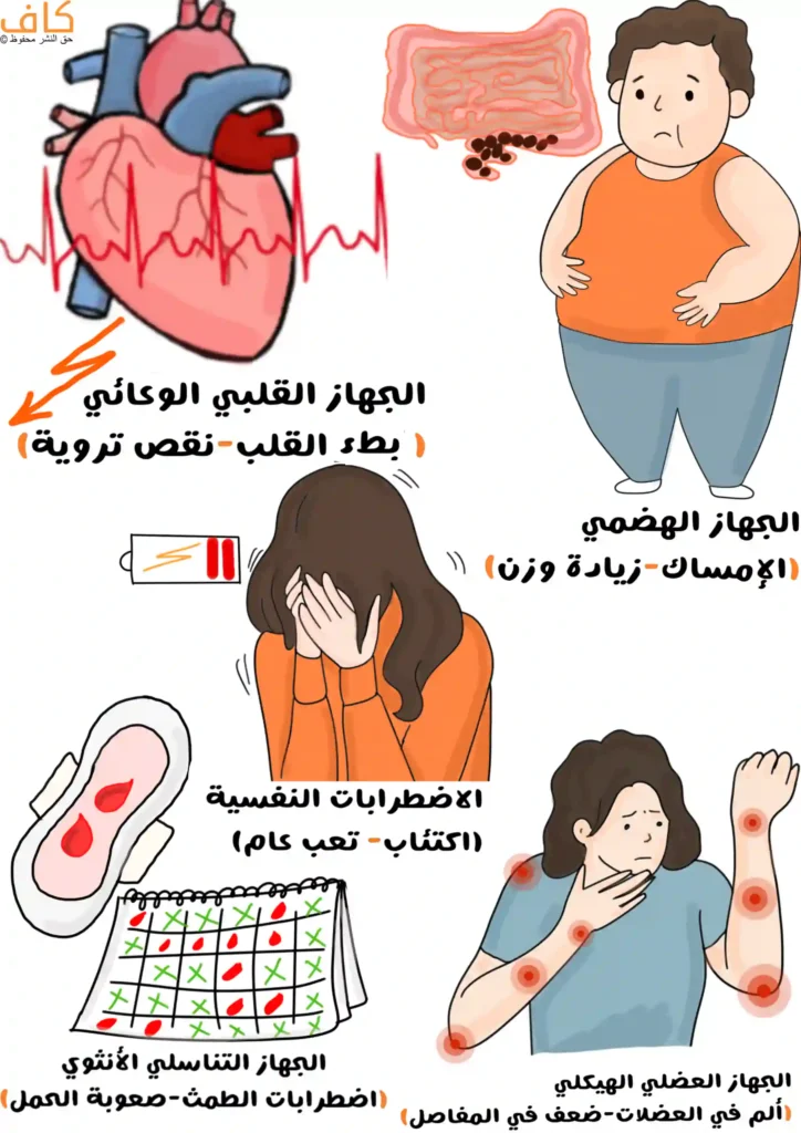 رسم توضيحي يوضح أعراض قصور الغدة الدرقية على أجهزة الجسم المختلفة، ويشمل تباطؤ القلب ونقص التروية، اضطرابات الجهاز الهضمي مثل الإمساك وزيادة الوزن، اضطرابات نفسية كالاكتئاب والتعب العام، اضطرابات الدورة الشهرية وصعوبة الحمل، إضافة إلى آلام العضلات وضعف المفاصل.