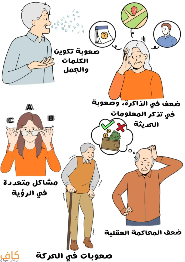 رسمة توضيحية توضح الأعراض التي تظهر على المصاب بالزهايمر مثل ضعف في الذاكرة وصعوبة في تكوين الجمل بالإضافة لمشاكل في الرؤية وضعف التوازن العقلي