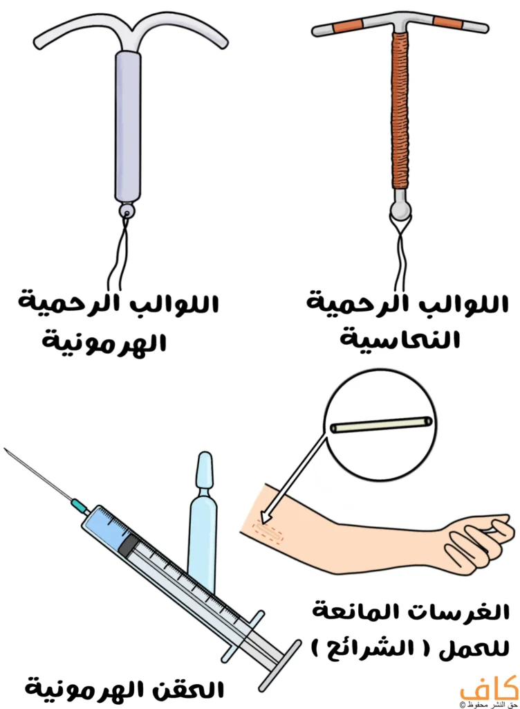 رسم توضيحي يُظهر أربع وسائل لمنع الحمل؛ لولب رحمي هرموني على شكل حرف T مع خيط سفلي، ولولب رحمي نحاسي ملفوف بسلك نحاسي، وحقنة هرمونية مع محقن وأمبولة، وذراع بشرية يظهر تحت جلدها قضيب صغير موضّح بدائرة، ويُعبّر عن وسائل منع الحمل طويلة المفعول.