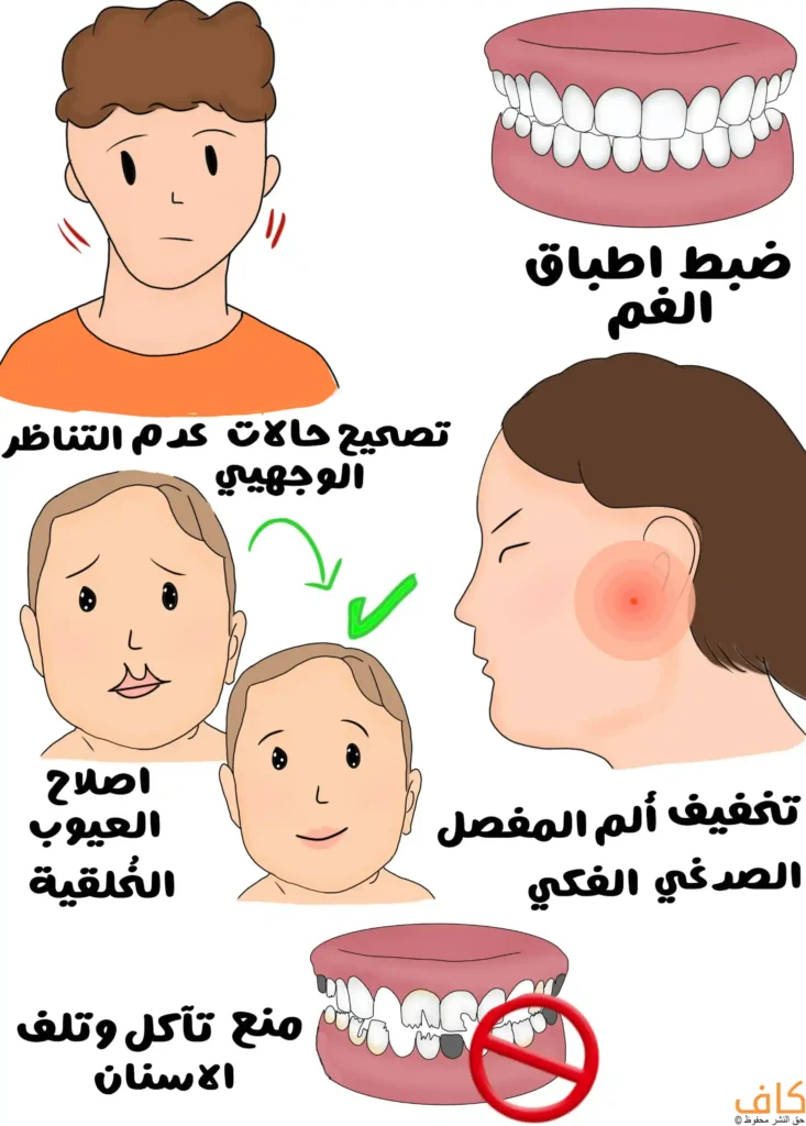 رسم توضيحي يُظهر مجموعة لقطات تشمل شابًا يعاني من عدم تناسق في عظام وجهه، وفك سفلي وعلوي تنطبق فيهما الأسنان على بعضها بشكل نموذجي، ووجهًا تظهر فيه بقع حمراء تدل على الألم قرب المفصل الفكي، وطفلًا قبل وبعد تصحيح شكل الفك لديه، وأسنان متآكلة مع علامة منع، ويُعبّر عن دواعي الجراحة التقويمية للفكين لمنع حدوث تآكل الأسنان.