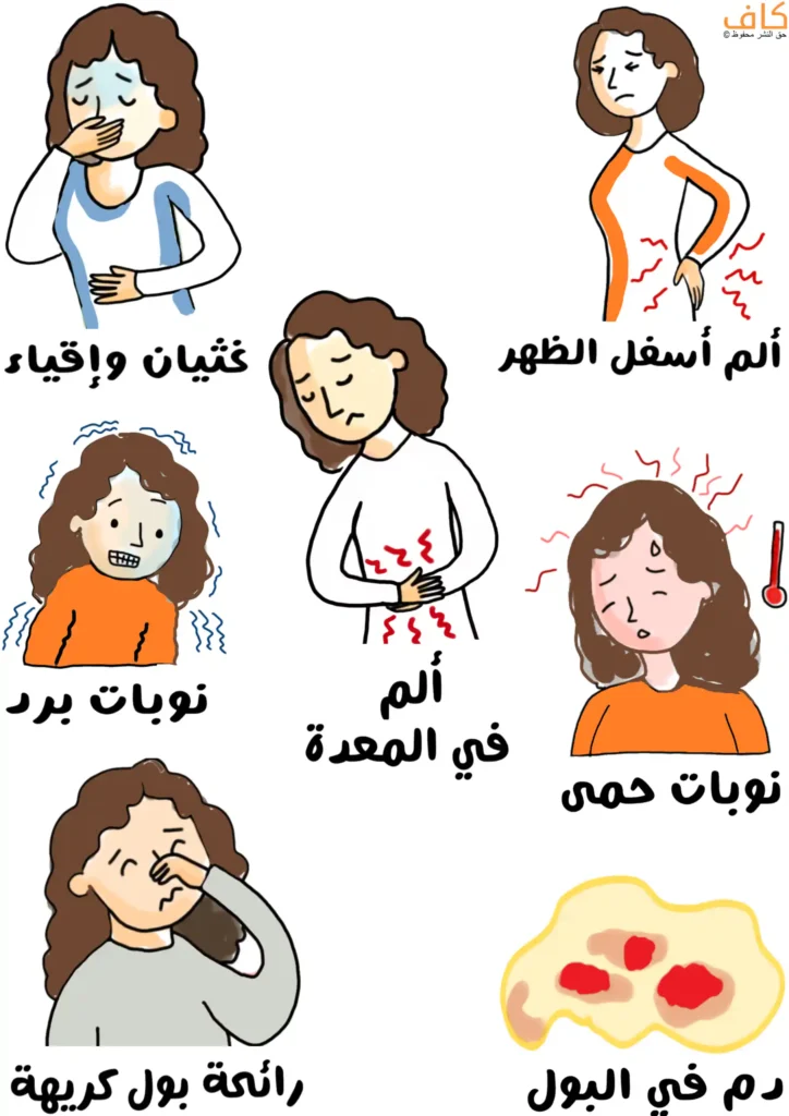 رسم توضيحي يبين أعراض حصيات حمض البول، ويشمل: امرأة تعاني من غثيان وإقياء، وأخرى تمسك أسفل ظهرها من الألم، وأخرى تشعر بآلام في المعدة، وفتاة ترتجف من البرد، وأخرى تعاني من نوبات حمى، وامرأة تسد أنفها لرائحة البول الكريهة، وصورة بول يحتوي على دم.