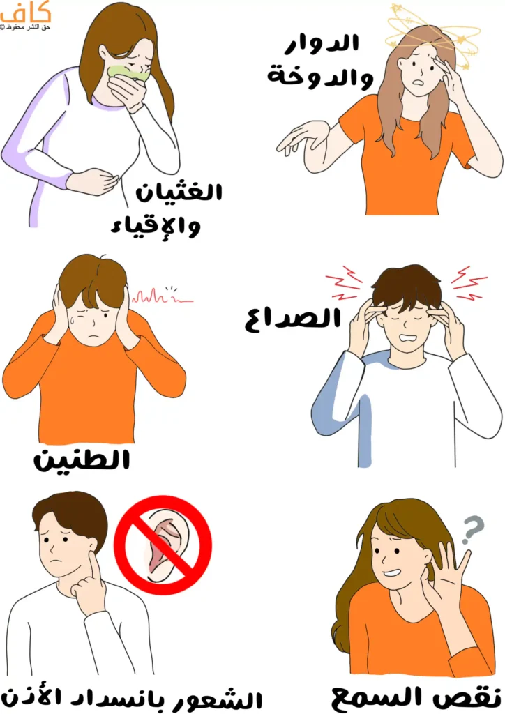 رسم توضيحي يُظهر مجموعة من الأشخاص يعانون من أعراض داء منيير، مثل الدوار وفقدان التوازن، والغثيان والإقياء، والصداع، وطنين الأذن، والشعور بانسدادها، ونقص السمع، ويُعبّر عن الاضطرابات السمعية والدوار الناتجين عن خلل في الأذن الداخلية.