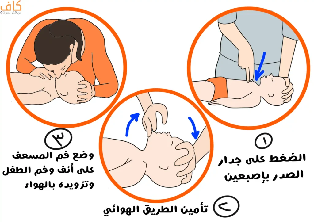 رسم توضيحي متسلسل يُظهر خطوات الإنعاش القلبي الرئوي لطفل، تشمل تأمين مجرى الهواء بإمالة الرأس، والضغط بإصبعين على منتصف الصدر، ووضع فم المُسعِف على فم وأنف الطفل لإعطائه نَفَسًا.