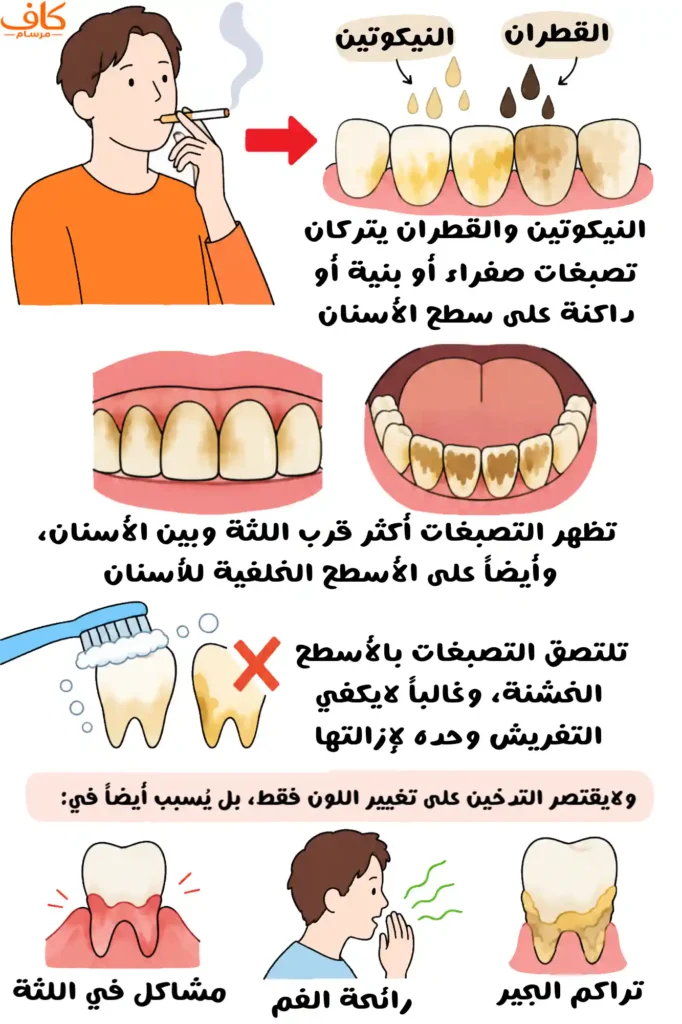 رسمة توضيحية توضح تأثير التدخين في تصبغ الأسنان باللون الأصفر والبني بسبب النيكوتين والقطران، مع تراكم الجير وظهور التصبغات قرب اللثة وبين الأسنان وعلى الأسطح الخلفية، إضافة إلى تأثيره في صحة الفم ورائحته.
