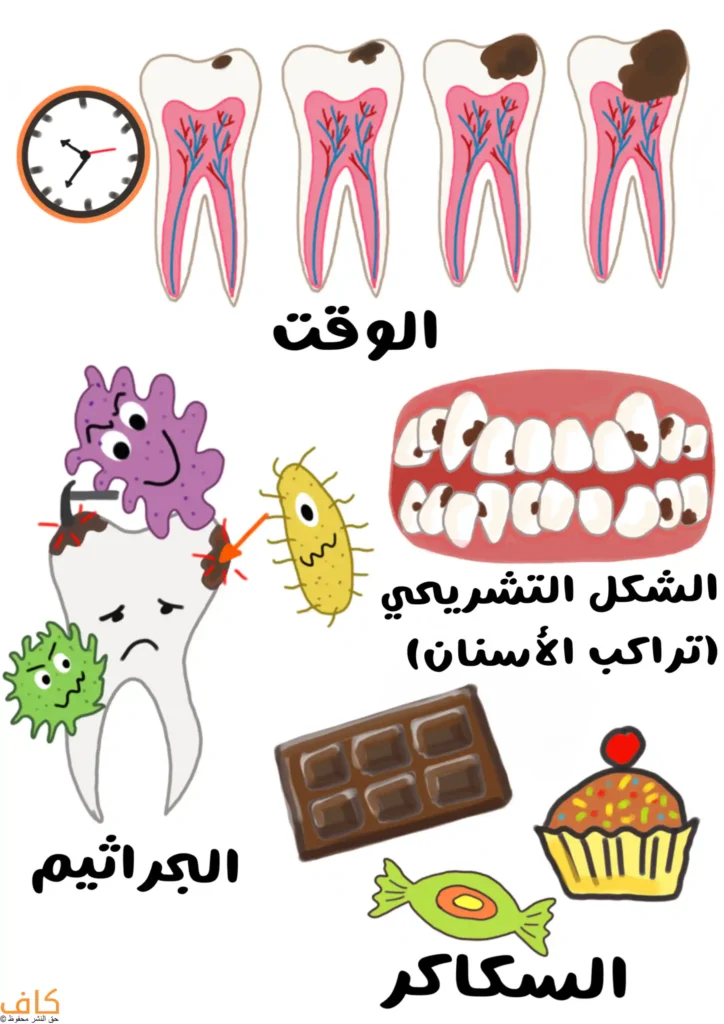 رسم توضيحي يضم عدة عناصر مرتبطة بالأسنان: تسلسل أسنان يظهر عليها بقع داكنة تكبر مع مرور الوقت مع رمز ساعة، سن محاط بكائنات دقيقة ملونة تشير إليه، صف أسنان تظهر عليه بقع بنية، ومواد غذائية سكرية مثل الشوكولاتة والحلوى والكعك.