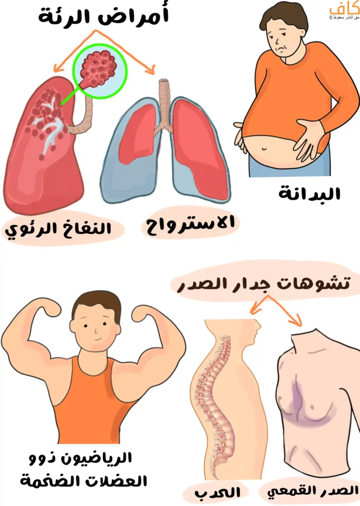 رسمة توضيحية تُظهر الحالات التي يكون فيها سماع صوت القلب صعبًا، وتشمل أمراض الرئة مثل النفاخ الرئوي والاسترواح، والبدانة، وتشوهات جدار الصدر كالصدر القمعي والحدب، إضافة إلى الرياضيين ذوي العضلات الضخمة.