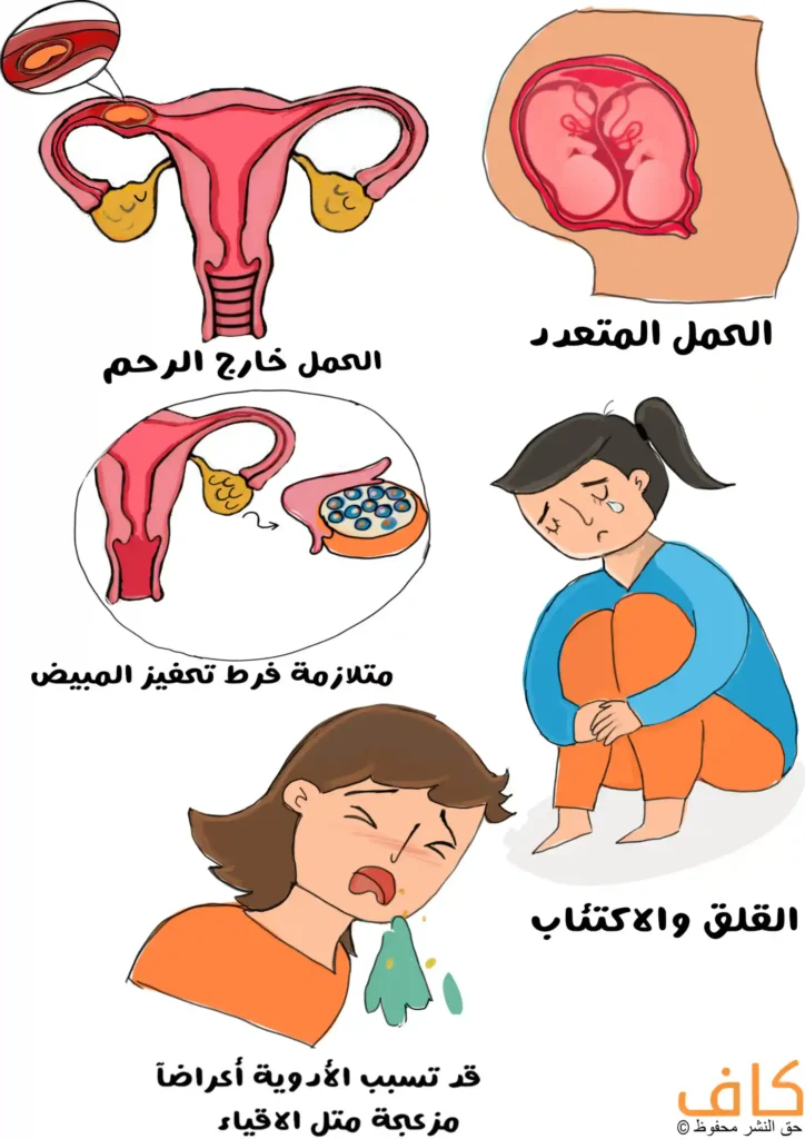 رسم توضيحي يوضح مضاعفات الإخصاب في المختبر، حيث تظهر رسومات للجهاز التناسلي الأنثوي مع الحمل خارج الرحم، والحمل المتعدد داخل الرحم، ومتلازمة فرط تحفيز المبيض مع تضخم المبيض وامتلائه بالبويضات، إضافة إلى امرأة تعاني من القلق والاكتئاب تجلس باكية على الأرض، وامرأة تتقيئ.