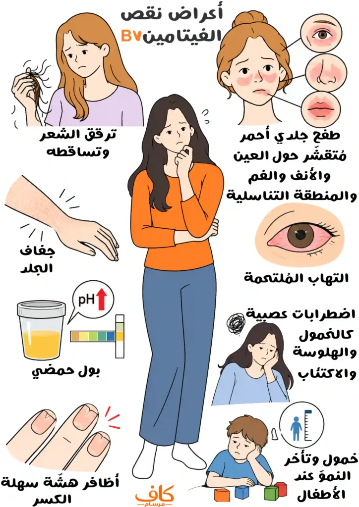 رسم توضيحي يوضح أبرز أعراض نقص فيتامين B7، ومنها تساقط الشعر والطفح الجلدي وجفاف الجلد والتهاب الملتحمة واضطرابات الجهاز العصبي وهشاشة الأظافر.
